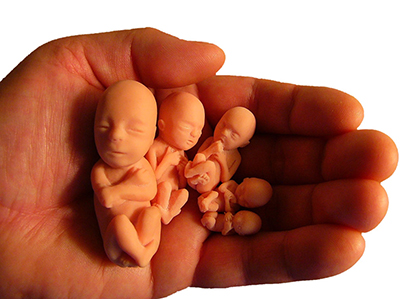سازمان پزشکی قانونی کشور مرجع صدور مجوزهای قانونی سقط جنین درمانی است